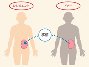 移植イメージ
